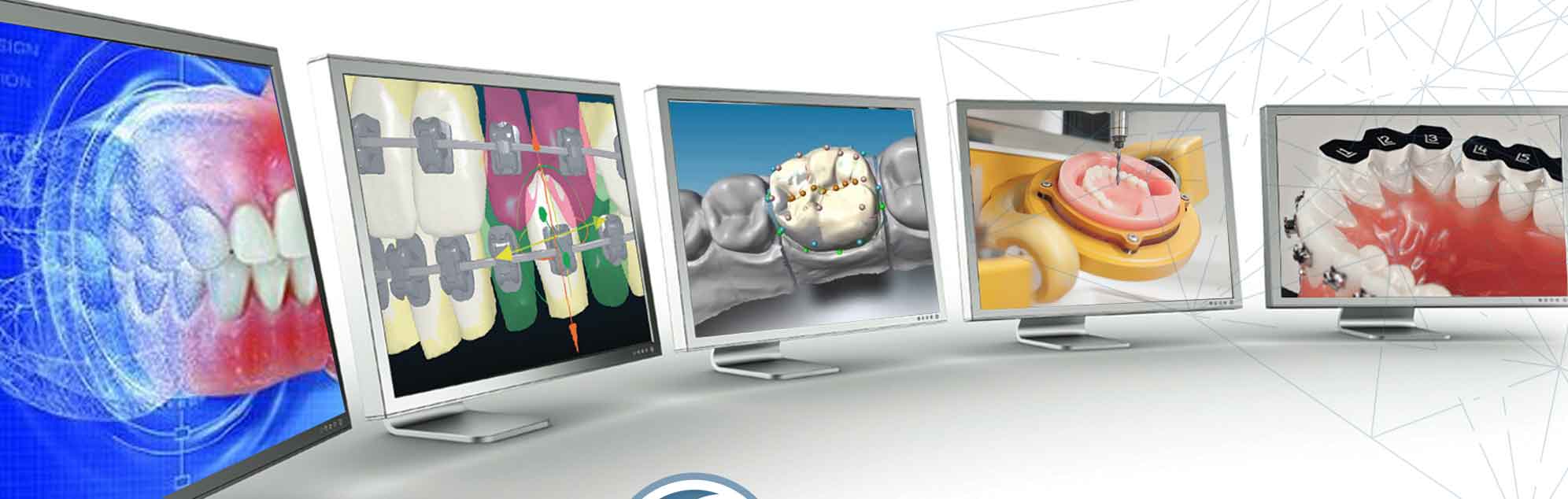 The Benefits of Having an On-site Digital Dental Lab