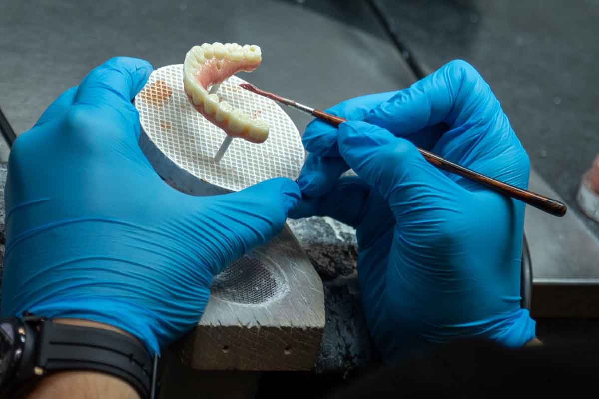 dental-implants-rocky-point-ny